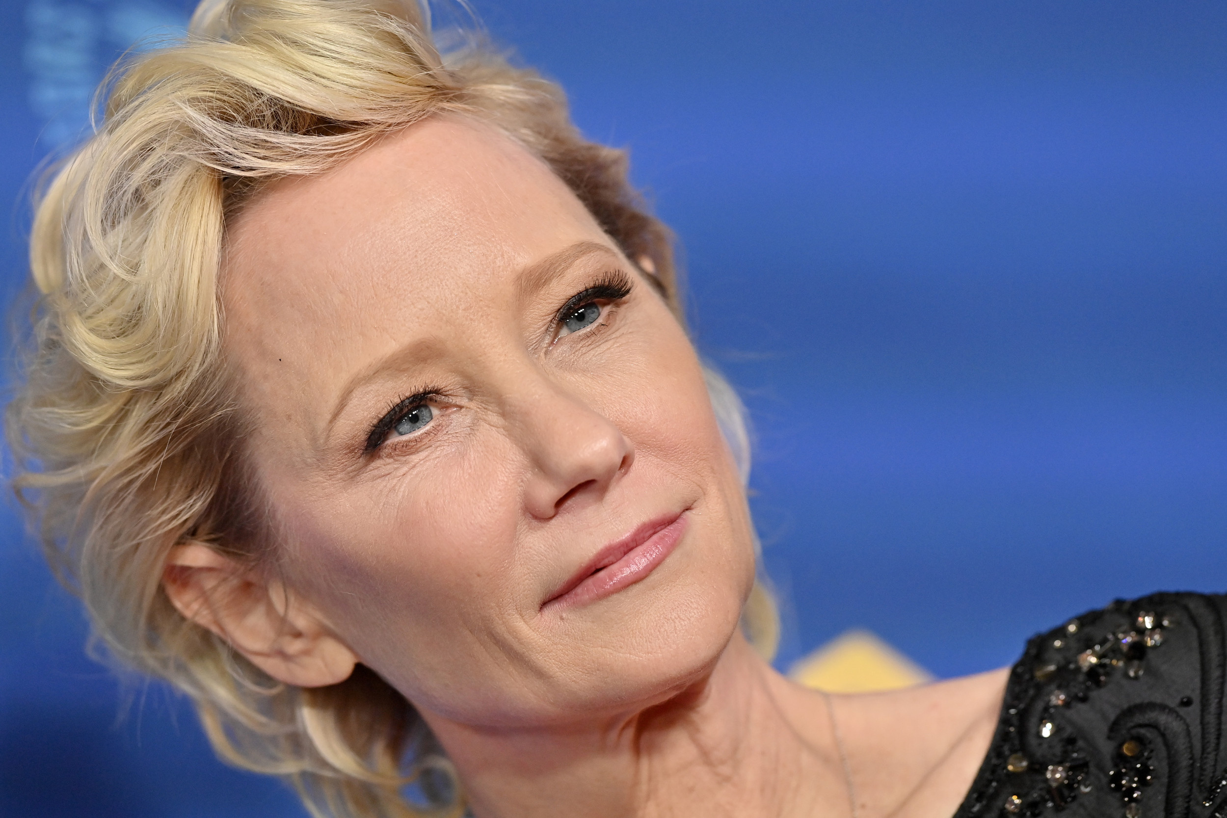 Anne Heche, Emmy winning actress, Legally dead, Car crash, 2500x1670 HD Desktop