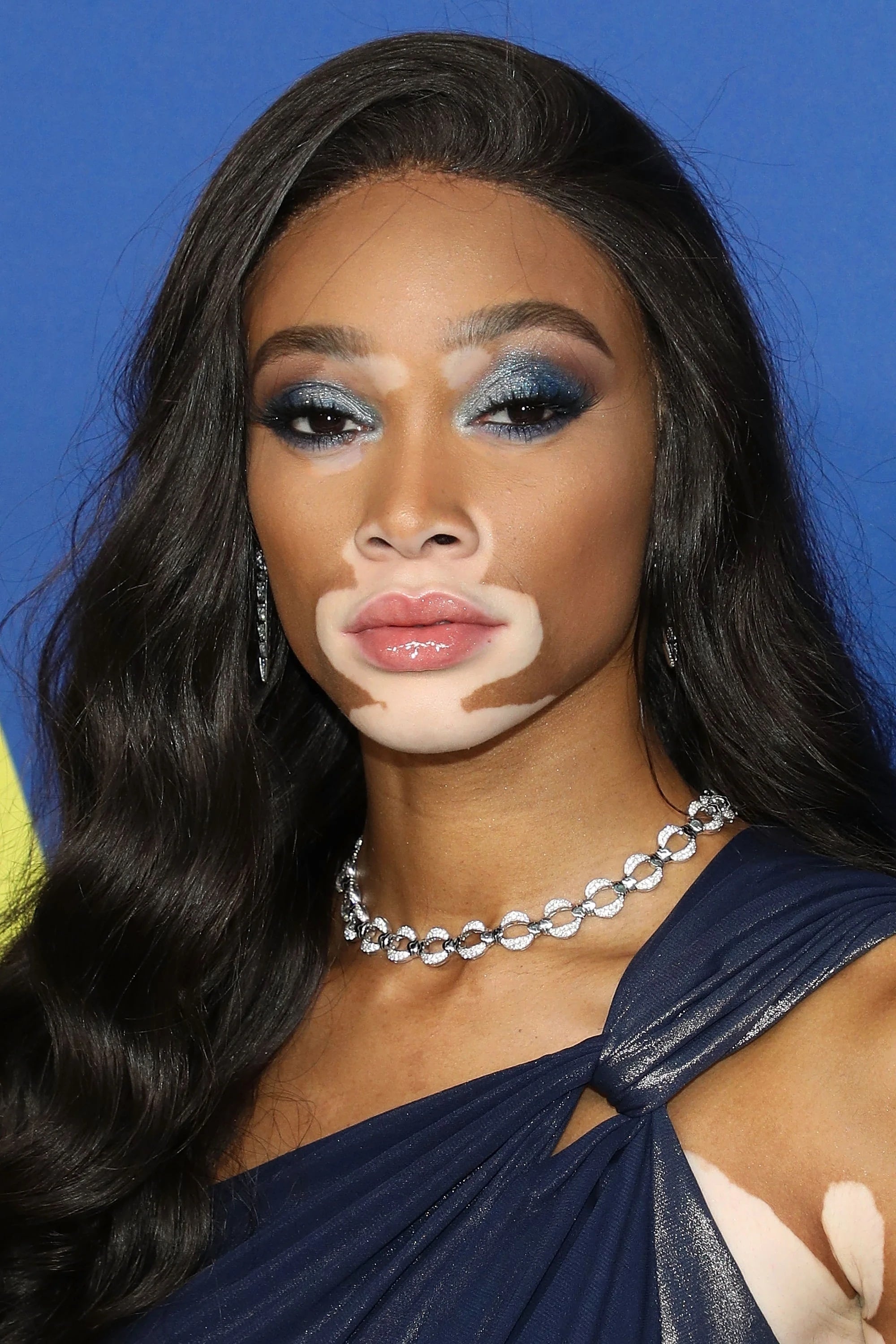 Winnie Harlow, Filme, Alter, Biographie, 2000x3000 HD Phone